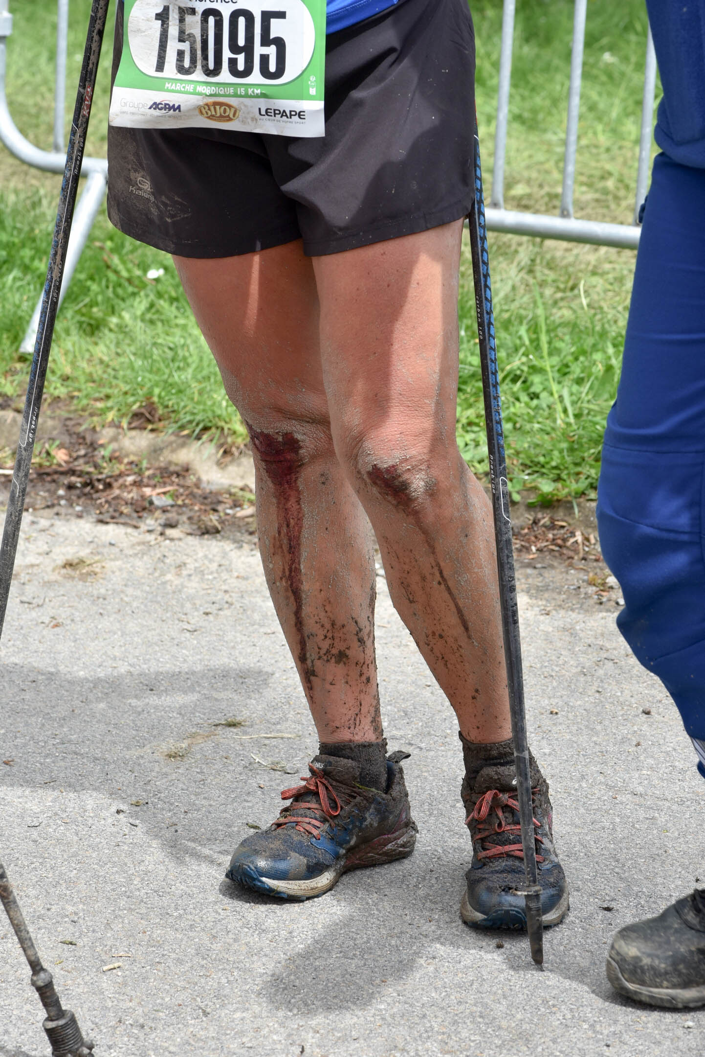 Jambes écorchées après la course